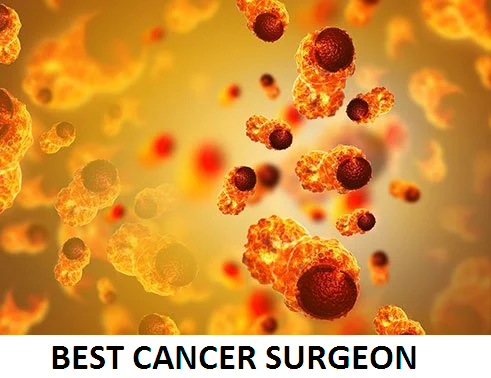 Best Cancer Surgeon
